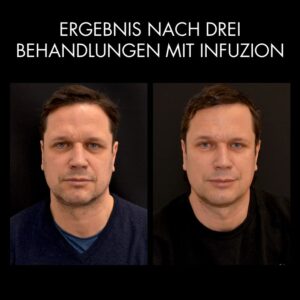 Vorher Nachher Christian SWE