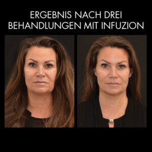 Vorher Nachher Madeleine