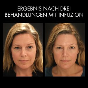 Vorher Nachher Mod3 SWE